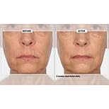 Signature Club A 5 Essentials Creme for Face and Eyes with Plant Stem Cell Complex
