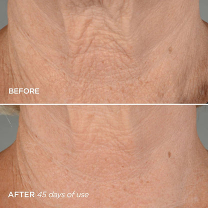 BEAUTYBIO THE LIFT PHASE 4 NECK FIRMING CONCENTRATE